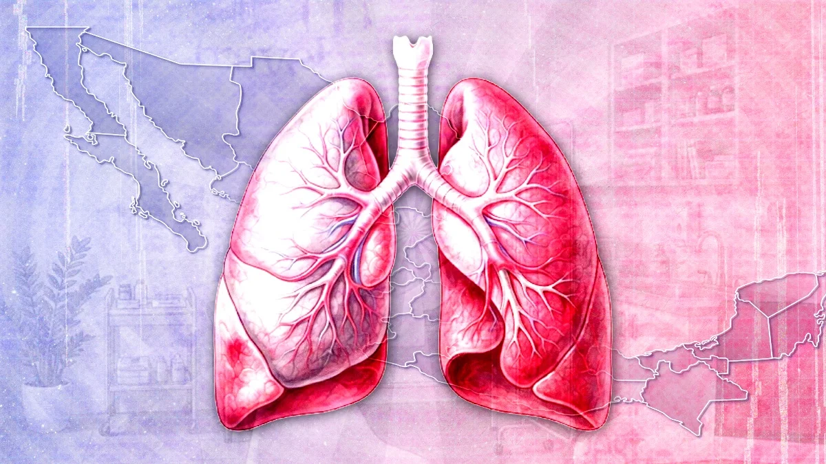 No sólo el COVID-19: México supera los 10 mil casos de tuberculosis, ¿a qué estados afecta más?